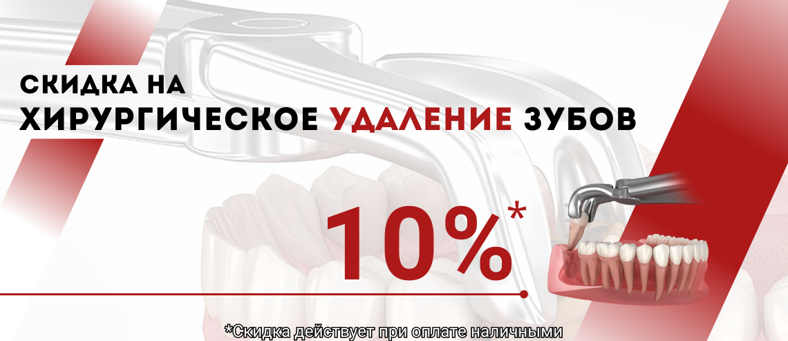 СКИДКА 10% НА УДАЛЕНИЕ