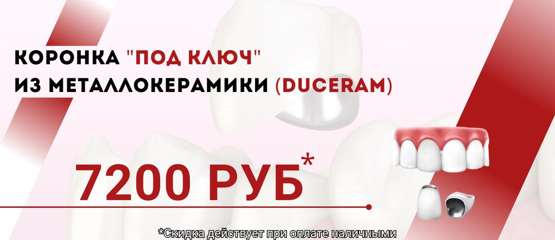 КОРОНКА ИЗ МЕТАЛЛОКЕРАМИКИ 7200 РУБЛЕЙ