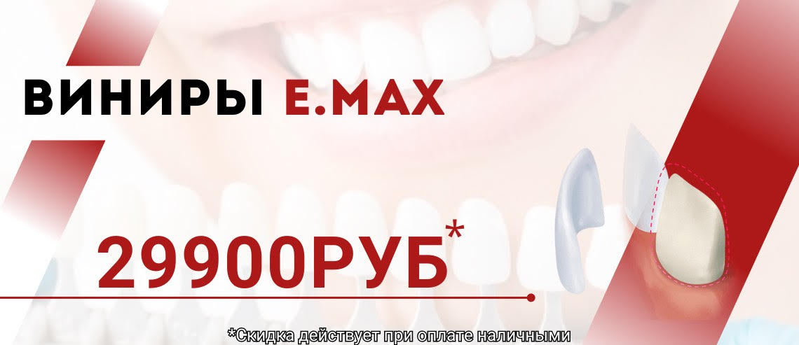 ВИНИР E.MAX за 29900 РУБЛЕЙ