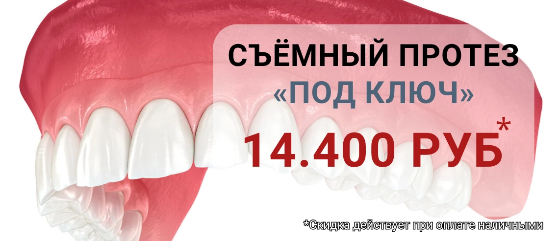 Съёмный протез «под ключ» — 14 400 ₽. Скидка действует при оплате наличными.